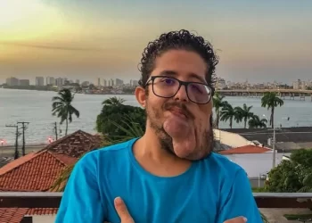 Corretor de Imóveis busca ajuda para remoção de tumores na face