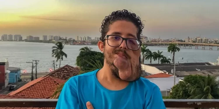 Corretor de Imóveis busca ajuda para remoção de tumores na face