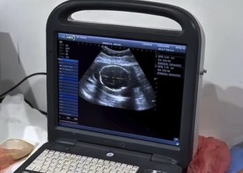 Sob a gestão do Prefeito Eustáquio Sampaio, Cidelândia dá salto na Saúde com exames de imagem e resultados imediatos