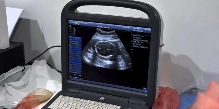 Sob a gestão do Prefeito Eustáquio Sampaio, Cidelândia dá salto na Saúde com exames de imagem e resultados imediatos